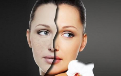 簡單的祛痘方法，讓你的皮膚時刻光滑細(xì)嫩